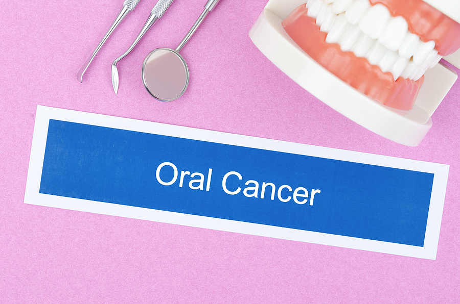 Oral Cancer