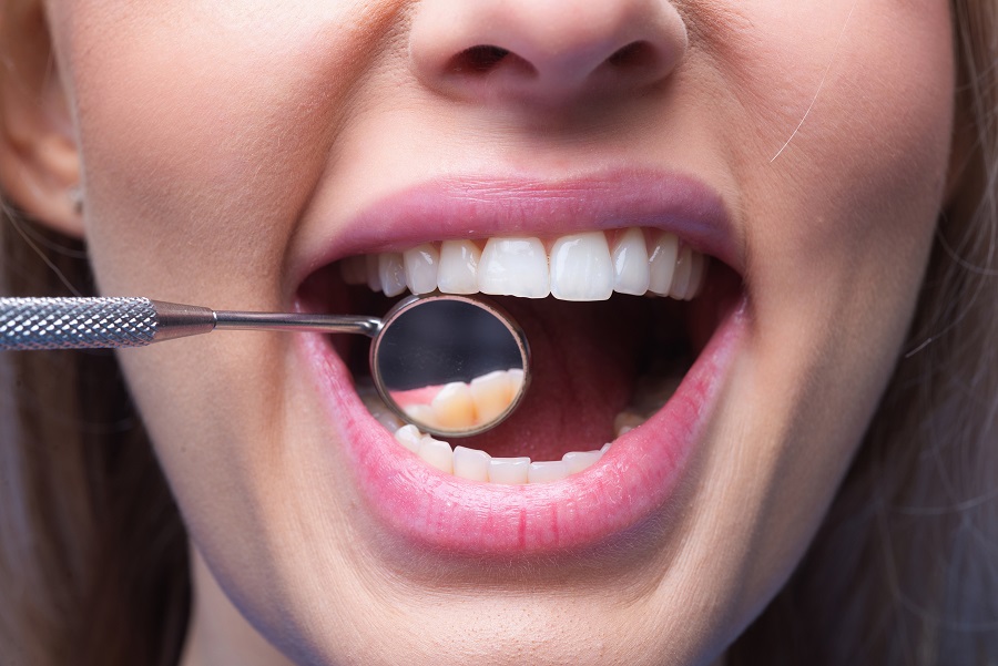 Dental Cleanings and Oral Hygiene