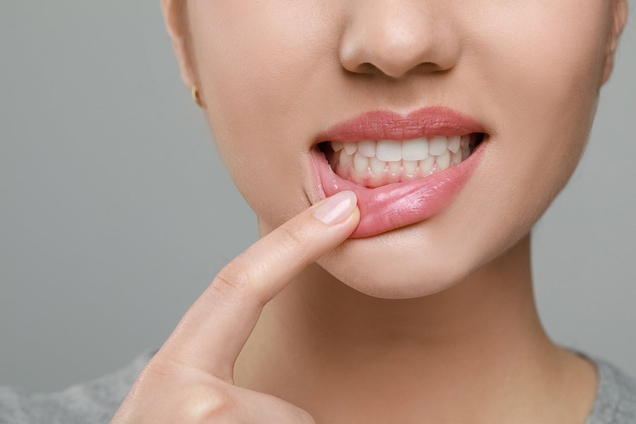 Non-Surgical Periodontal Treatment