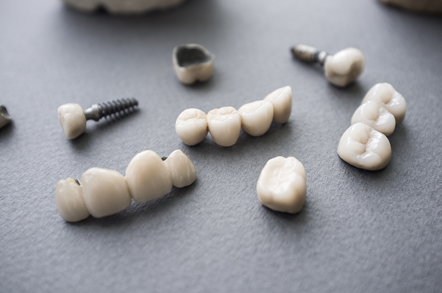 Restore Your Smile with High-Quality Crowns in Jamaica, NY